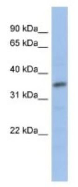 MYF-5 Rabbit anti-Human, Mouse, Polyclonal, Novus Biologicals:Antibodies:Primary